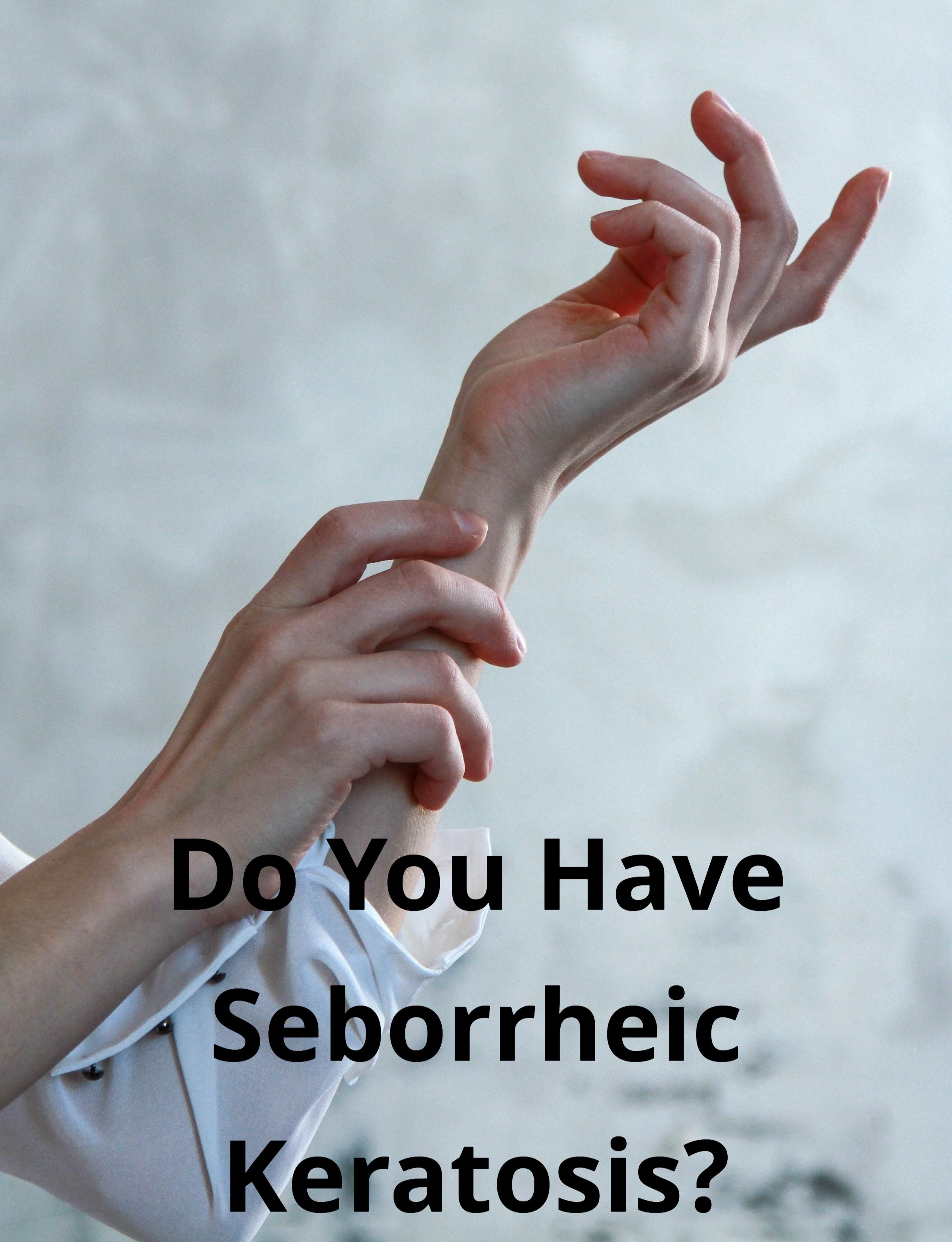Do You Have Seborrheic Keratosis?